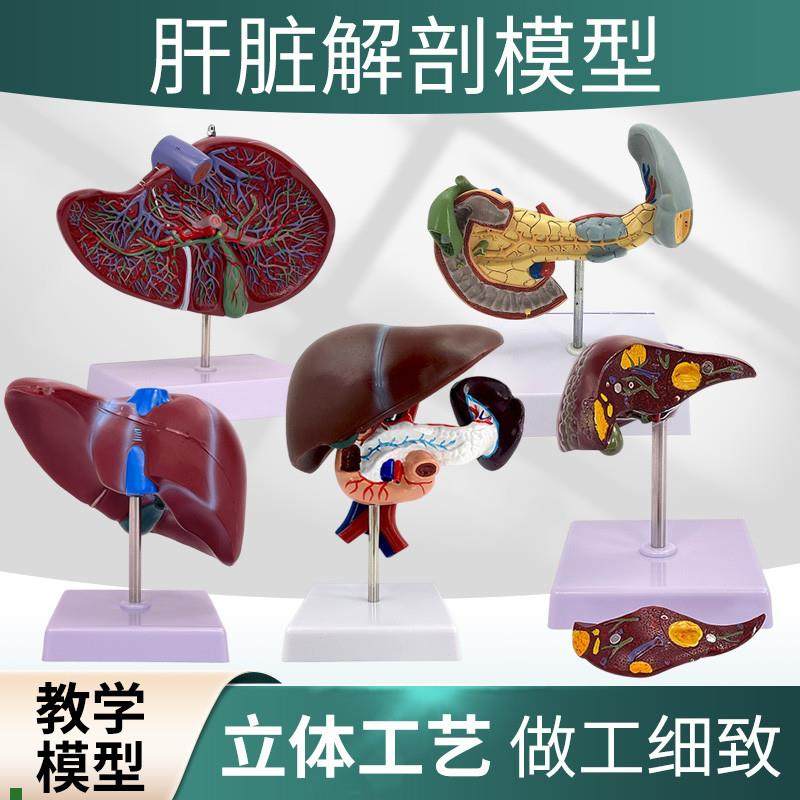 人体肾脏模型肾解剖附肾上腺放大C模型病变肾脏人体内脏器官解剖