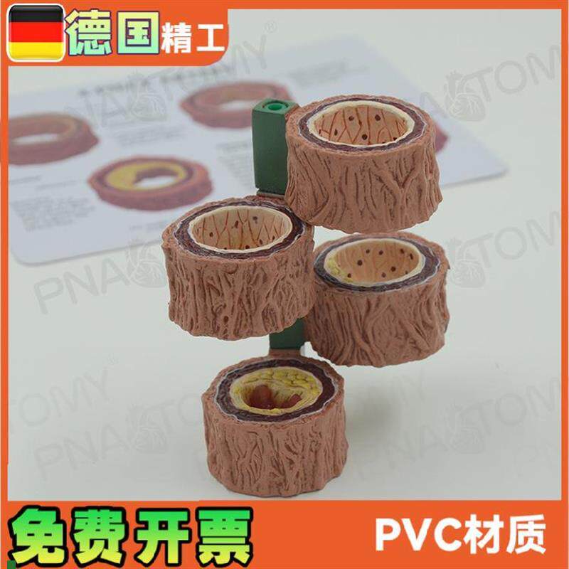 四阶段动脉血管模型p粥样化演示教具血管硬化解剖展示模具礼品