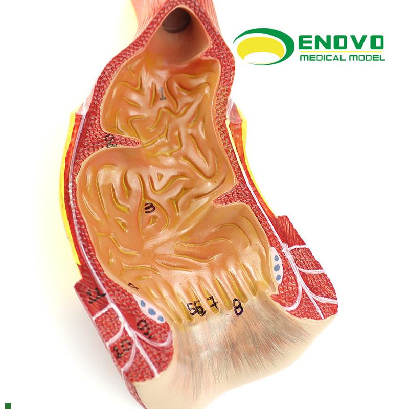 ENOVO颐诺医学人体直肠肛y管肛门解剖结构模型肛肠科外科普外科