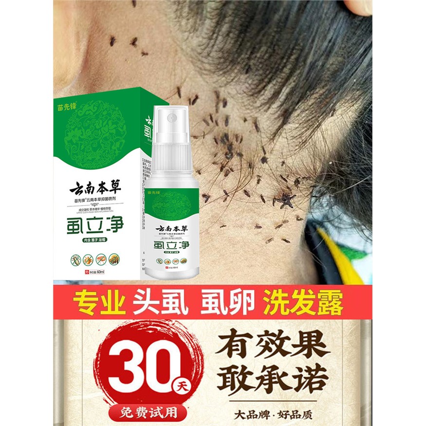 【新人专享价】虱子药头