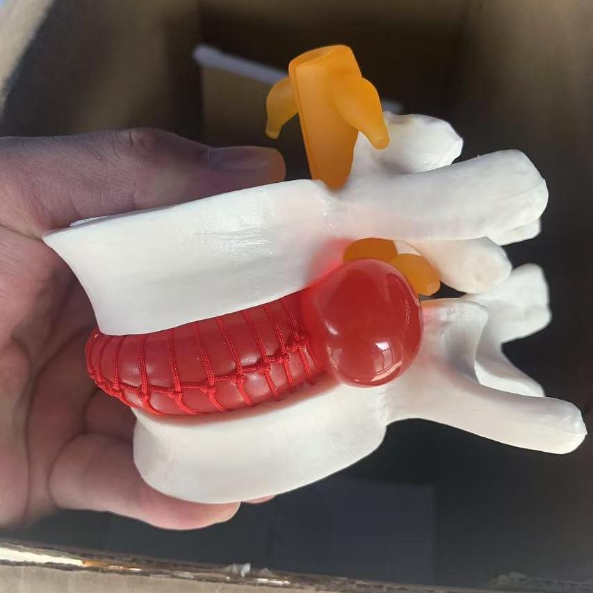 医患讲解道具腰间盘突出模型