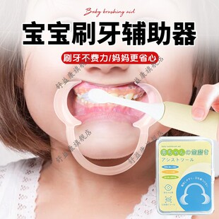 宝宝刷牙辅助器刷牙助手防咬嘴巴扩张开口刷牙扩嘴刷牙神器