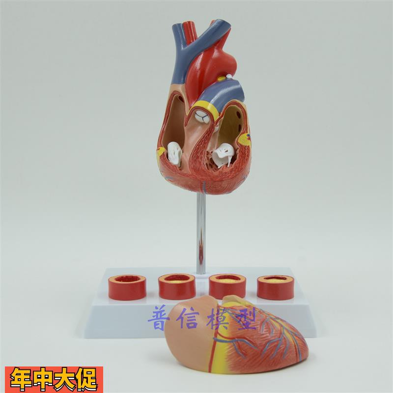 普信豪华心脏模型带4阶段血管教学医用心脏解剖模型心血管