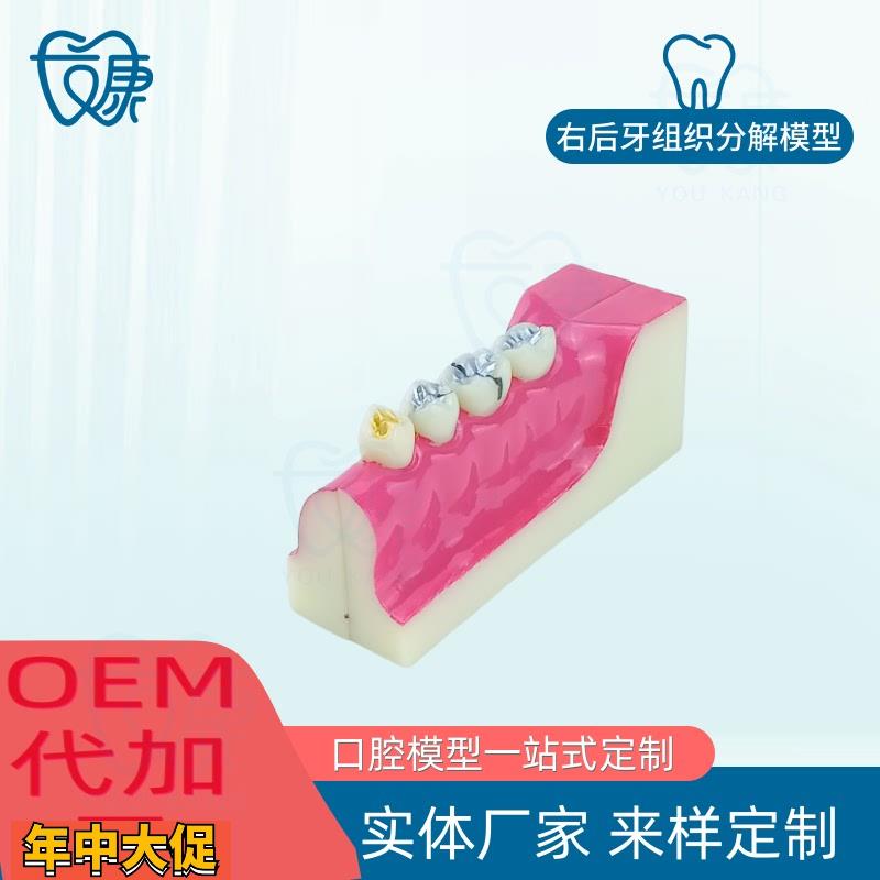 牙科口腔牙齿模型右后牙组织分解牙模型分解口腔展示标准医患沟通