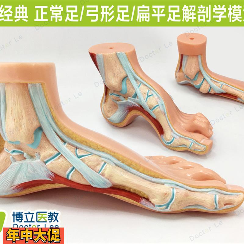 高端3款1:1足病理对比扁平足弓形足健康足模型走路姿势矫正模型