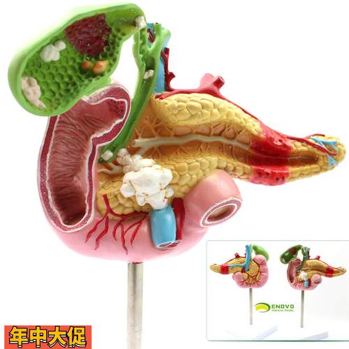 ENOVO颐诺医学胰腺十二指肠胆囊病理模型外科消化科系统模具肝胆