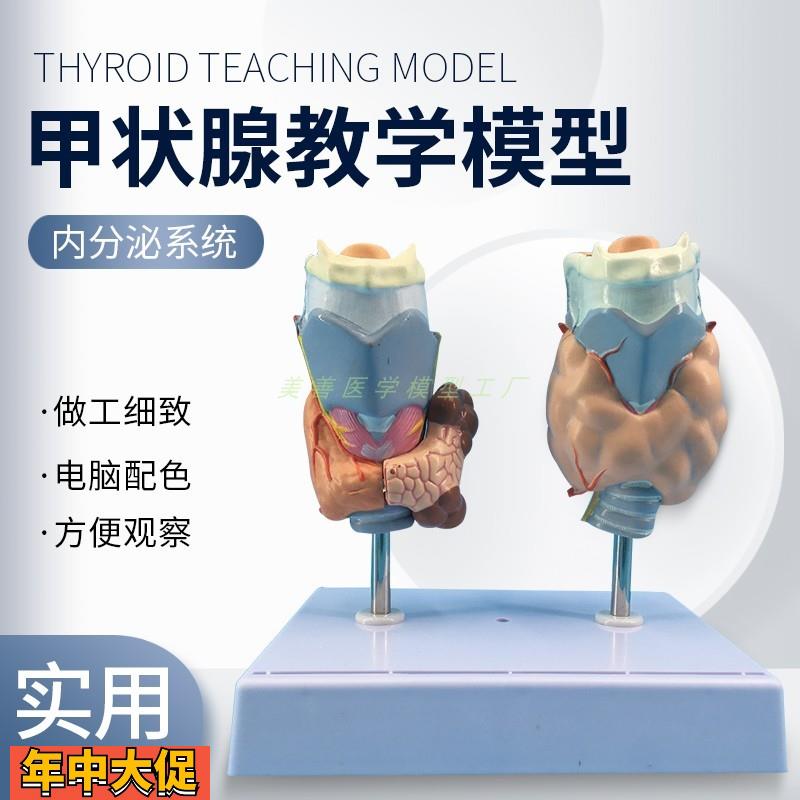 病理甲状腺模型喉头解剖模型甲状腺留甲状线囊中甲状线病