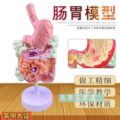 正品人体结肠病变模型肛肠科消化内科大肠模型医学人体解剖包邮