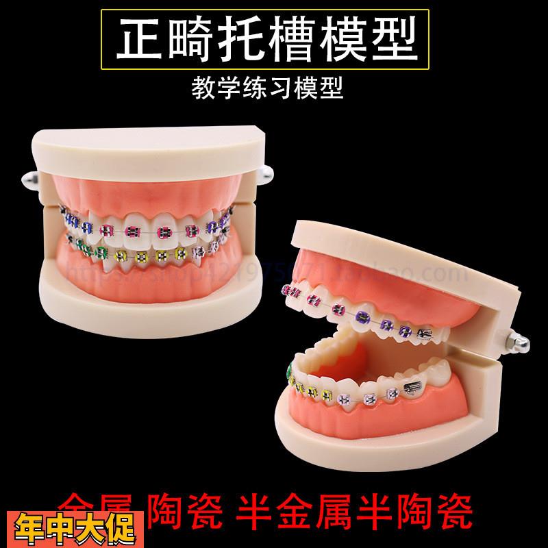 牙科正畸带托槽假牙模型医患沟通教学模型矫正练习托槽模型包邮