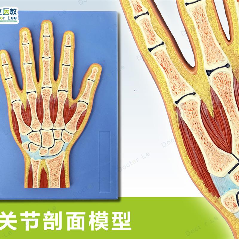 人体断层扫描手关节切面浮雕手关节断层解剖学模型ct运动解剖