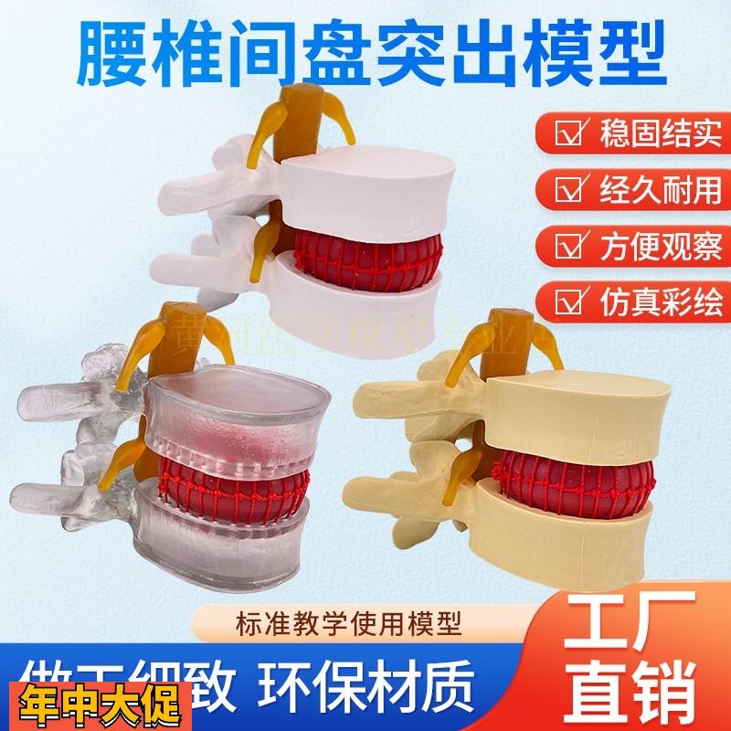腰椎模型教学医学人体腰椎间盘受压演示脊柱骨突出病理骨质教具