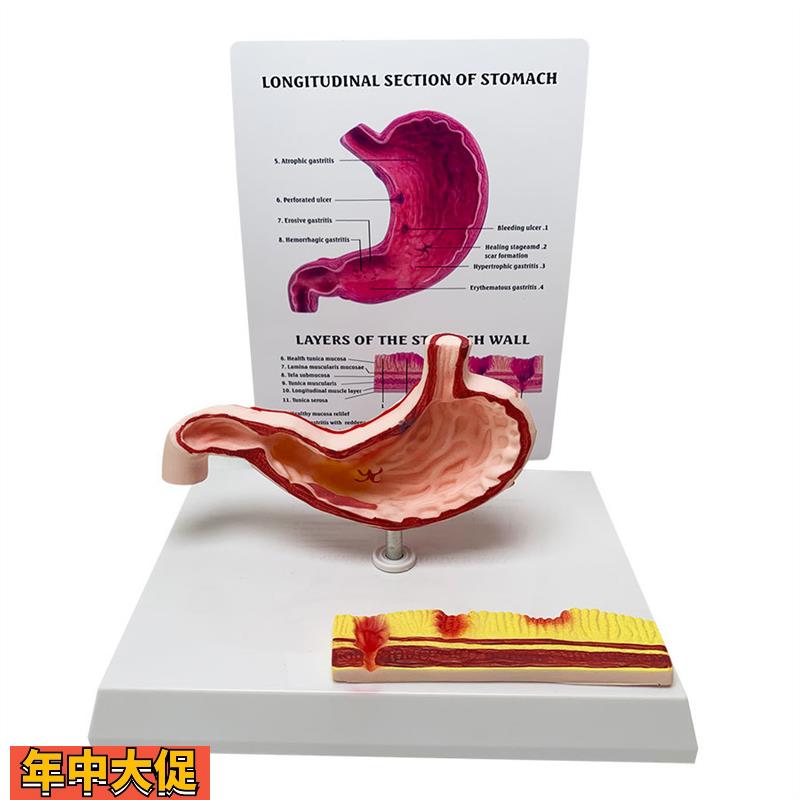 胃解剖模型胃腹腔病态解剖模型结构人体教学教具人体解剖