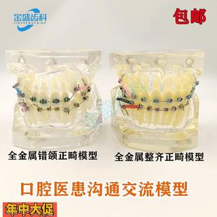 牙科模型正畸结扎丝托槽口腔教学模型牙齿错颌矫正展示透明牙模