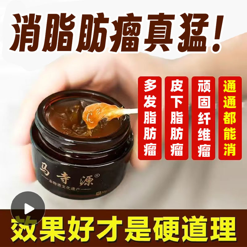 脂肪瘤消瘤膏皮下肿瘤硬块去除神器全身多发性纤维瘤克星专用特效