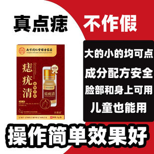 点痣祛痣药膏无痕点痦子去志取黑痣去除神器不留疤美容院正品药水