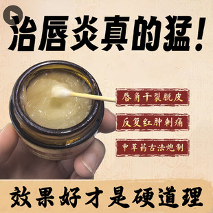 唇炎唇膏嘴唇干裂脱皮修护膏儿童嘴角开裂口角炎去死皮专用医用型