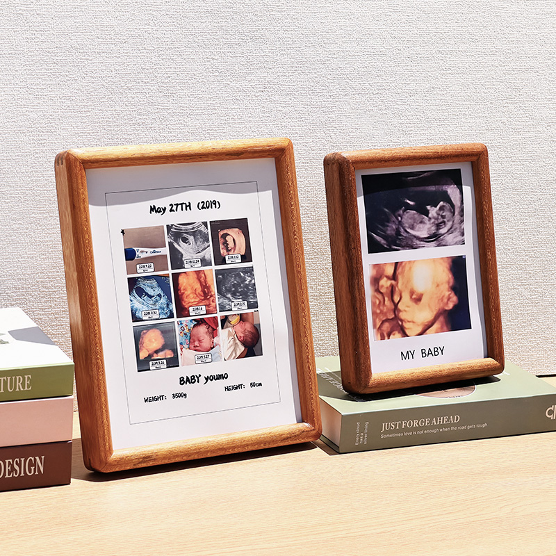 b超相框四维彩超照片宝宝三维孕妇孕检早期24周照片婴儿出生礼物