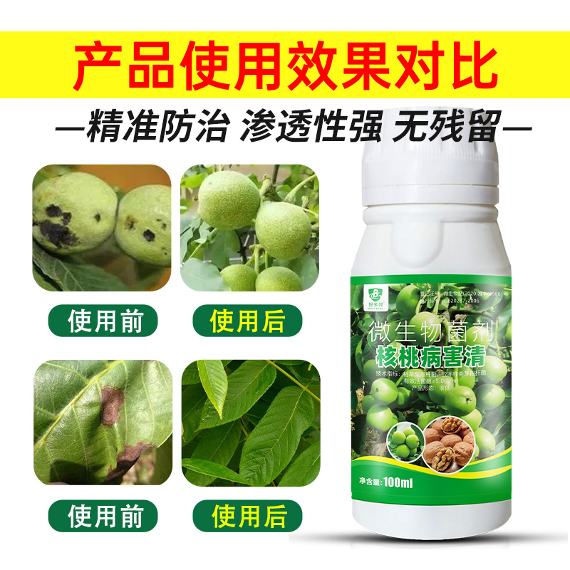 核桃树专用药炭疽黑斑褐斑树干流汁水落果专用杀菌剂核桃病一喷净