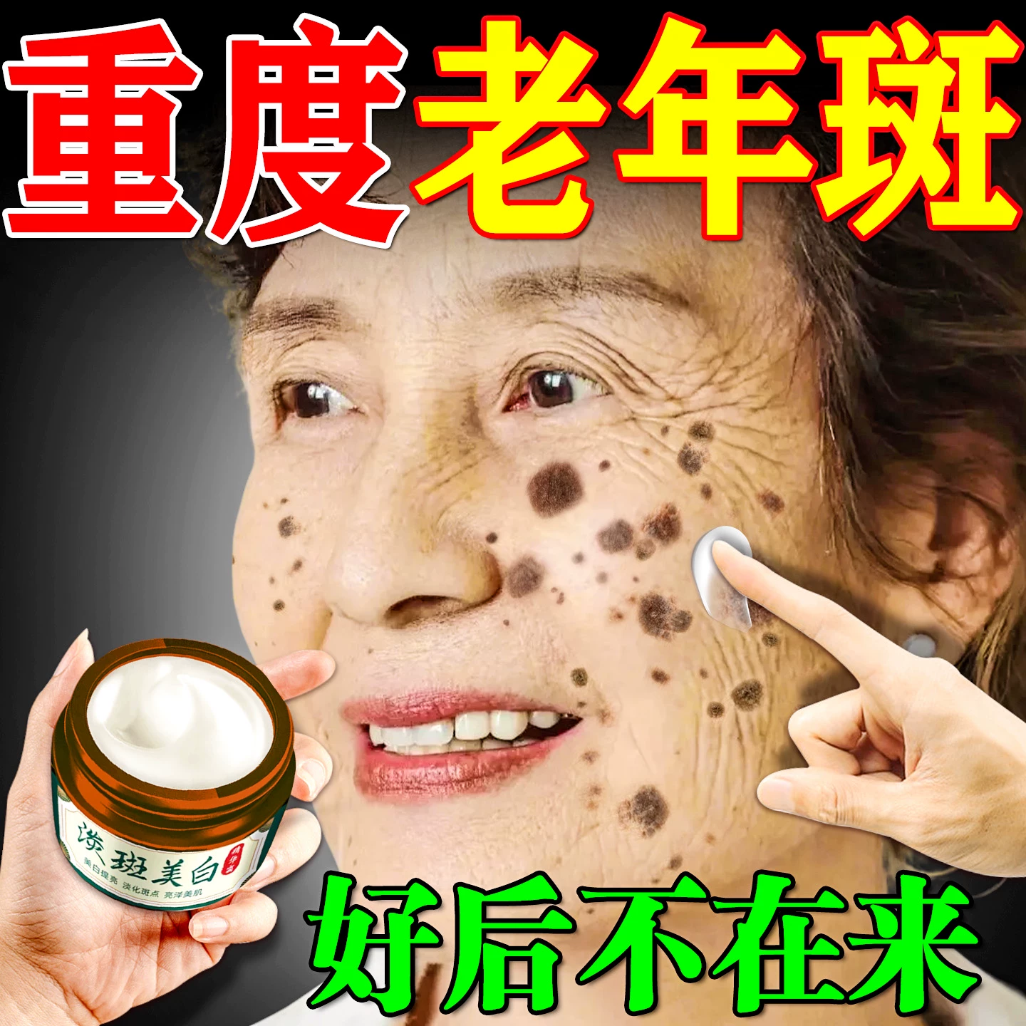 去老人斑专用药膏一擦就掉强力去除老年祛斑祛黄褐斑雀斑官方正品