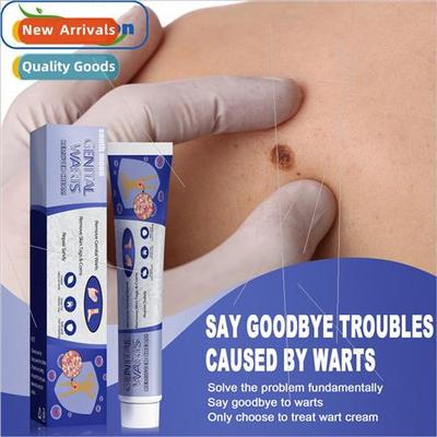Flat Monkey Wart Cream Hand Foot Face Flesh Fili适用m Warts