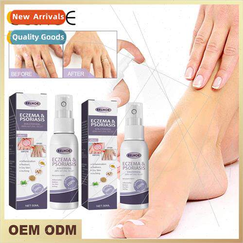 Hand and Foot Moss Spray Hand and Foot Moss Skin Repair Reli