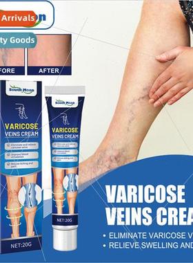 Vein Massage Varicose Vein Cream Relieve Bulging Blood Vesse