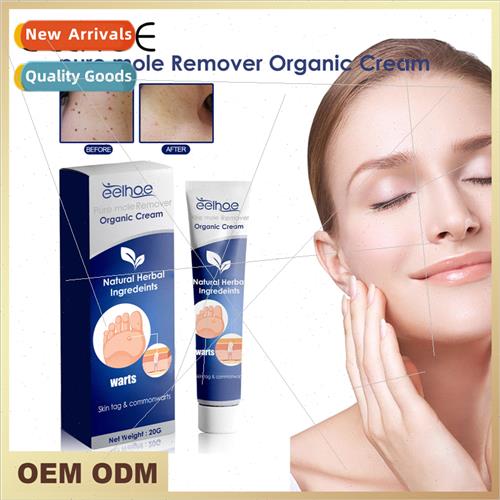 Wart Cream Skin Tag Removal Fade Moles Moles Chicken Eye Rep