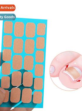 Ingrown Nail Correcti Stainless Steel Clip & Buckle Inward G