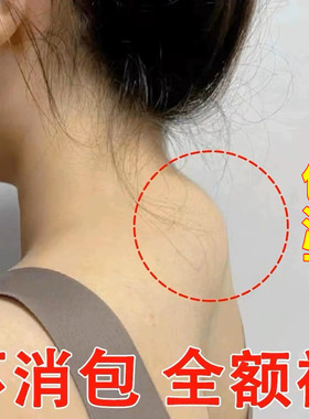 去富贵包神器【100%冶愈】  解决各种颈椎问题    只要富贵不要包