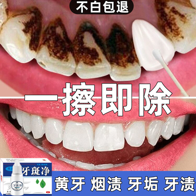 牙粉美白去黄洗白清洁牙齿污垢变亮白烟渍黑去除神器溶解牙石速效