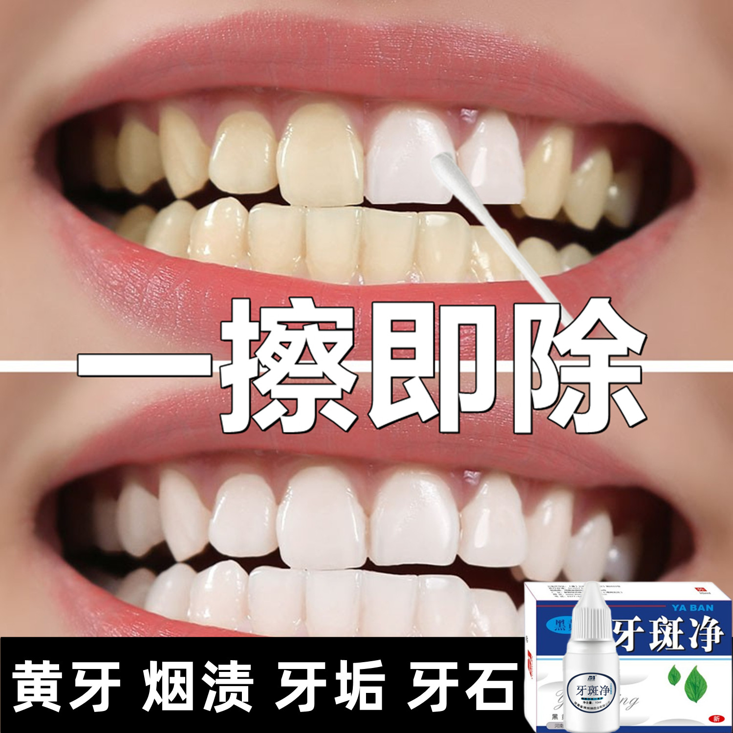 洗牙粉去黄美白牙齿污垢变亮白去除烟渍清洁剂神器牙结石溶解速效