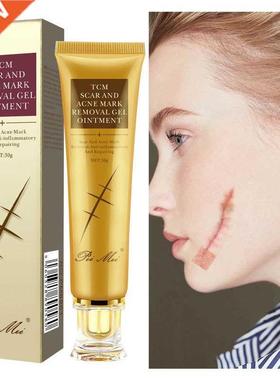 Acne Scar Removal Cream Repair Stretch Marks Gel Remove Burn