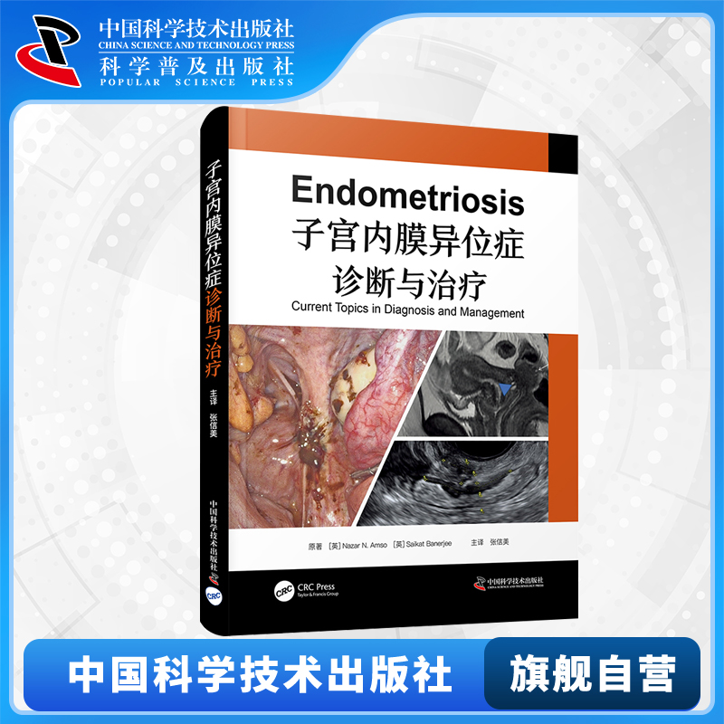 【中科社】子宫内膜异位症诊断与治疗 内异症的起源临床特点和延迟诊断超声检查和磁共振成像在诊断内异症时的特征表现