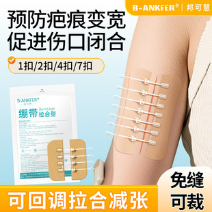 医用减张贴器儿童免缝合皮肤疤痕甲状腺术后手术拉合伤口张力贴