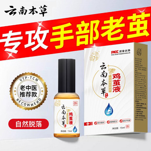 云南本草去手茧清茧灵老茧手茧子去除神器软化剂茧洁士茧清茧立净