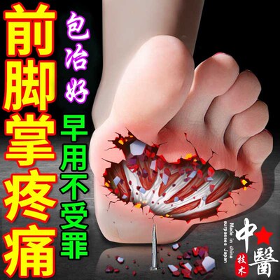 前脚掌疼痛脚底筋膜炎脚底板疼活血走路疼脚底脚背疼跟腱炎止痛油
