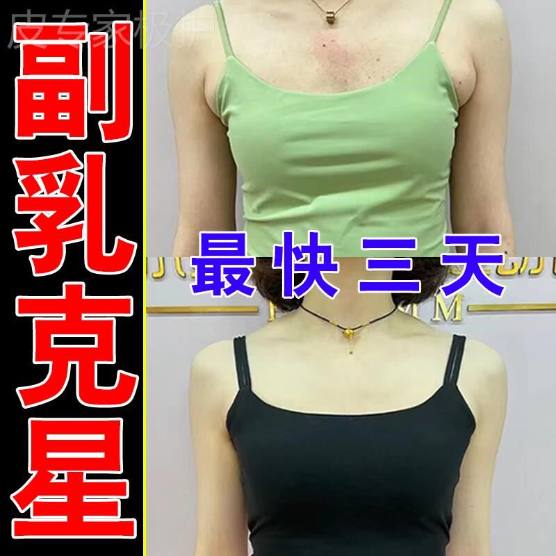 【快3天去副乳】副乳消除贴去副乳神器腋下淋巴堵塞疏通散结贴