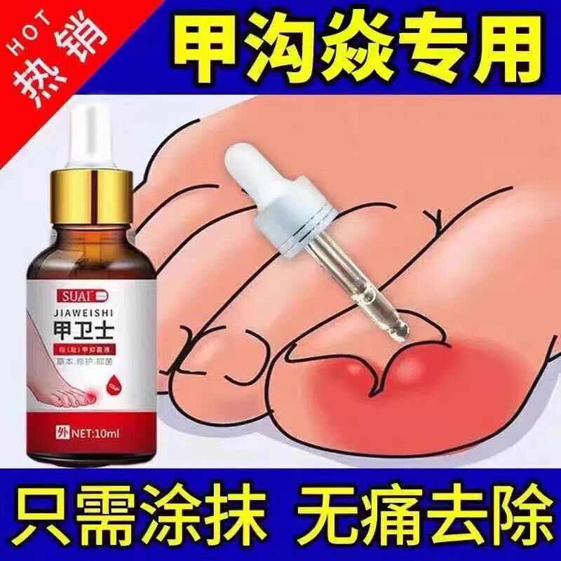【严重甲沟炎专用】去肉芽脚趾甲往肉里长嵌甲红肿疼痛化脓抑菌液