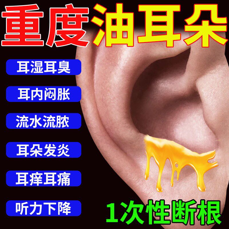 油耳朵清洁器耳耵聍清洗滴耳液软化耳屎耳垢克星喷雾掏耳专用神器