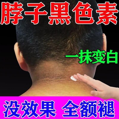 黑棘皮药膏去肥胖黑脖子色素沉淀洗不干净皮肤干燥粗糙去除死皮