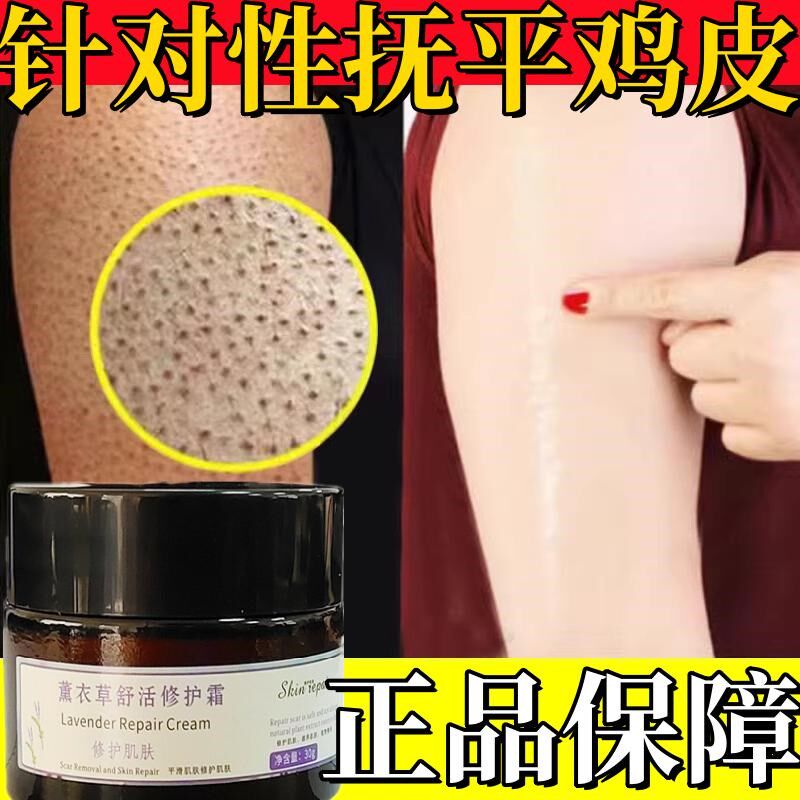 鸡皮肤疙瘩毛囊角质化霜去除神器手臂大腿背上脸部脖子小红点黑点