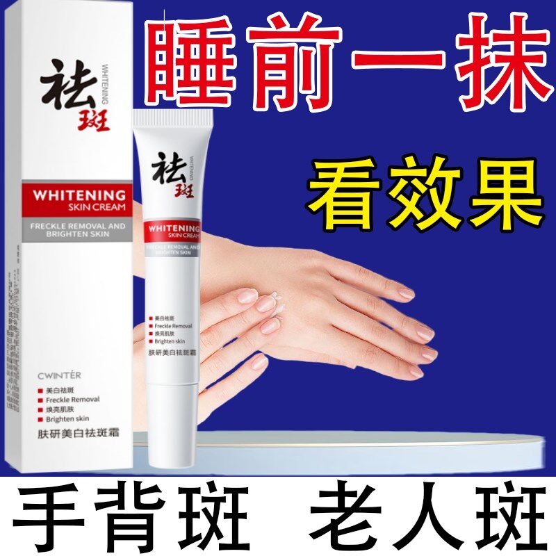 去斑霜专治祛老年斑专用脸部去手上手部手背的药膏强力去除老牌子