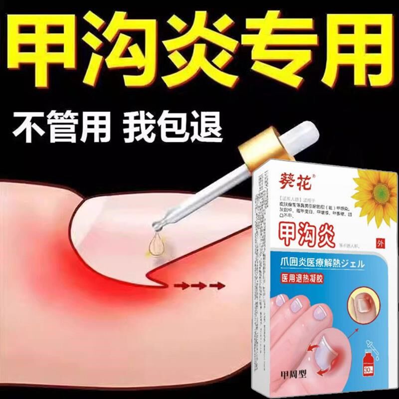 甲沟炎脚趾甲往肉里长用正品化脓息肉去除消肿去肉芽嵌甲真菌感染