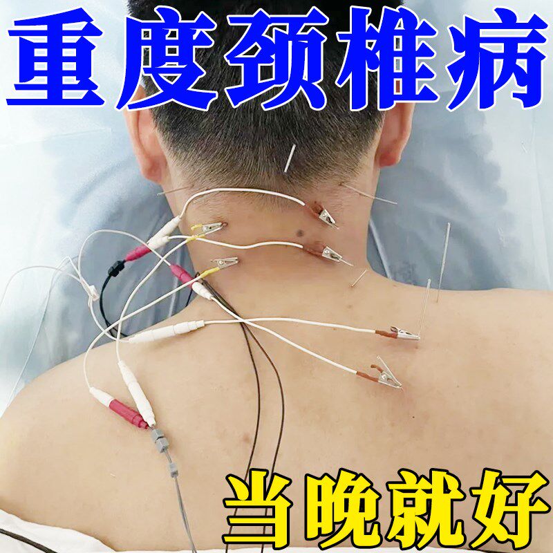 【冶好百万人】颈椎压迫神经缓解头晕脖子疼僵硬手麻颈椎特校贴膏
