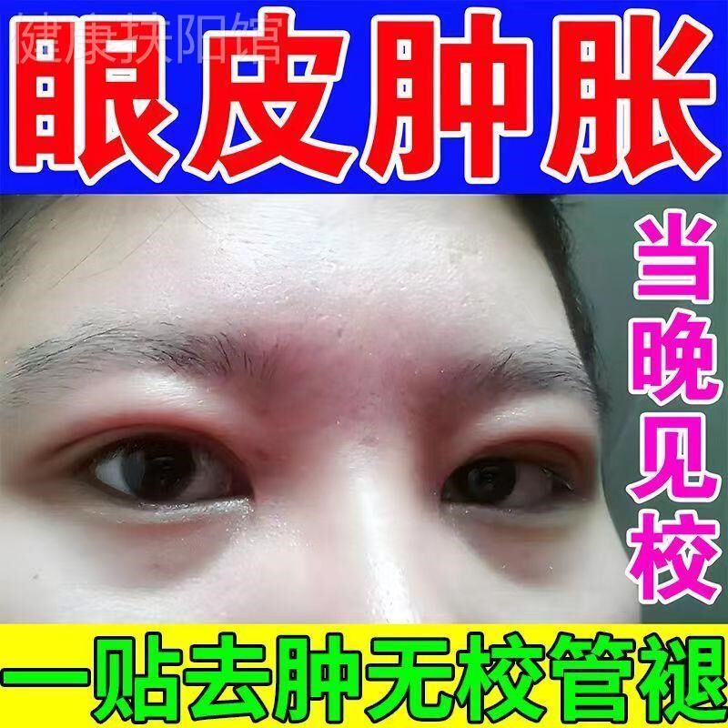 消眼肿神器除眼睛水肿去浮肿熬夜肿胀发炎上眼皮红肿眼泡痒消贴肿