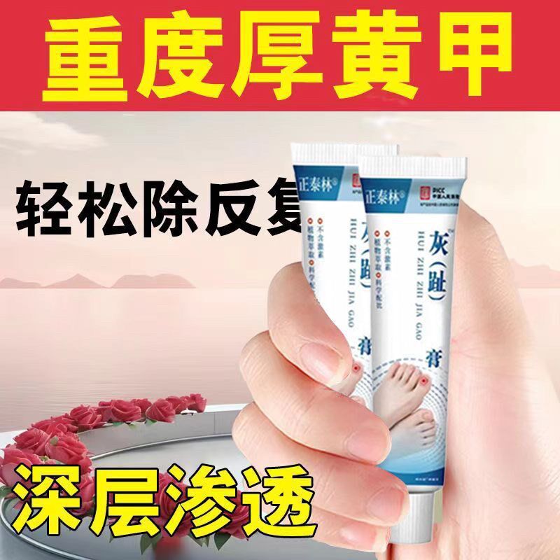 正品快速趾甲脚趾变色灰指甲增厚修复草本无痛亮甲