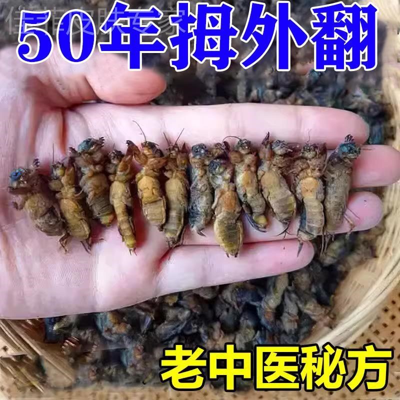 【拇指外翻三天好】拇指外翻拇外翻矫正器大脚骨变形脚趾重叠贴Y