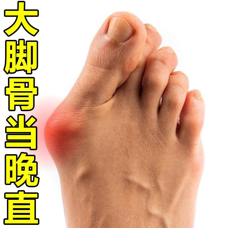 拇外翻贴脚趾重叠防磨大脚骨外翻矫正专用膏药