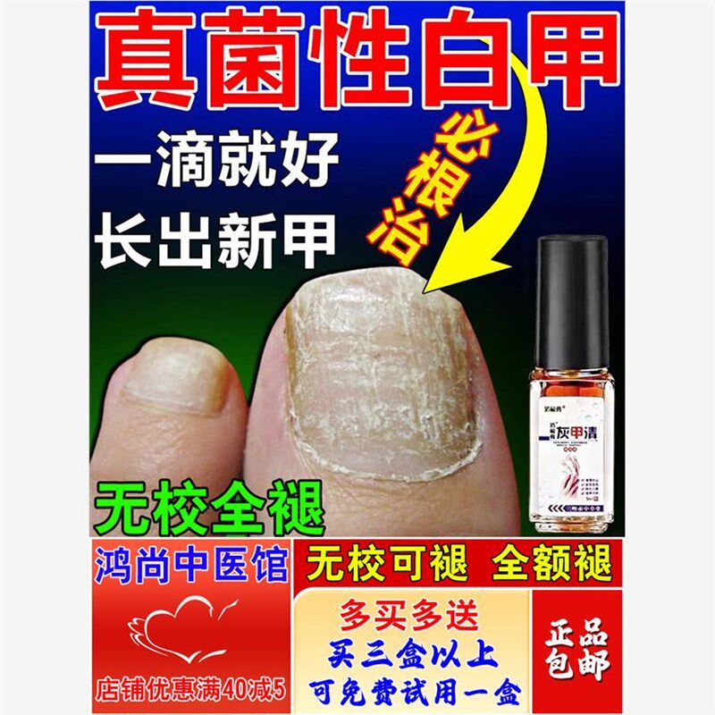 真菌性白甲脚指甲盖变厚发黄增厚趾甲变硬空灰甲床分离修复好变坏