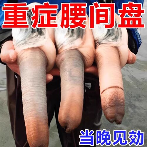 【能痊愈】腰痛压迫神经引起屁小腿麻疼股疼腰疼椎凸出下肢乏力感